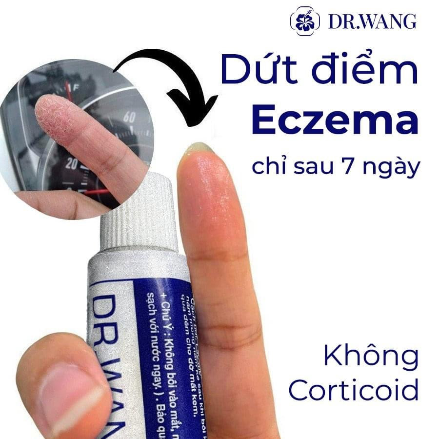 Kem Dr.Wang Derma Đặc trị da liễu Eczema